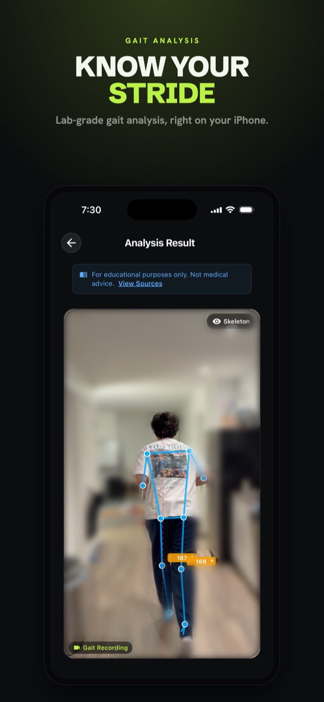 AI gait analysis result with on-device skeleton overlay